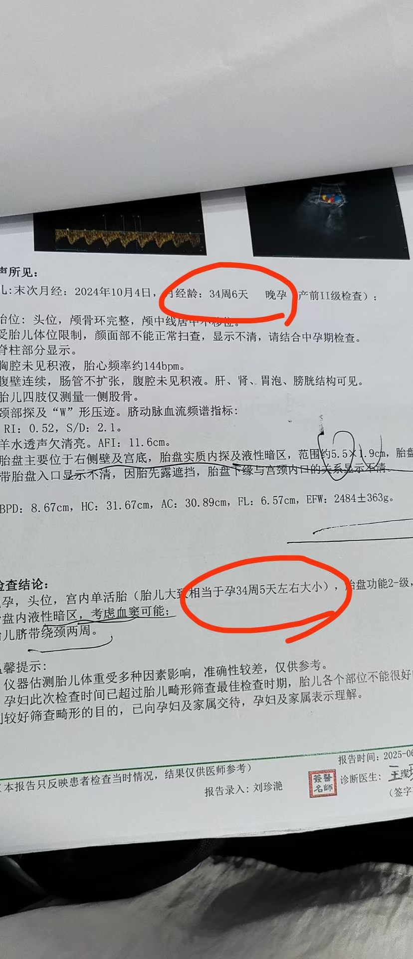 B超单