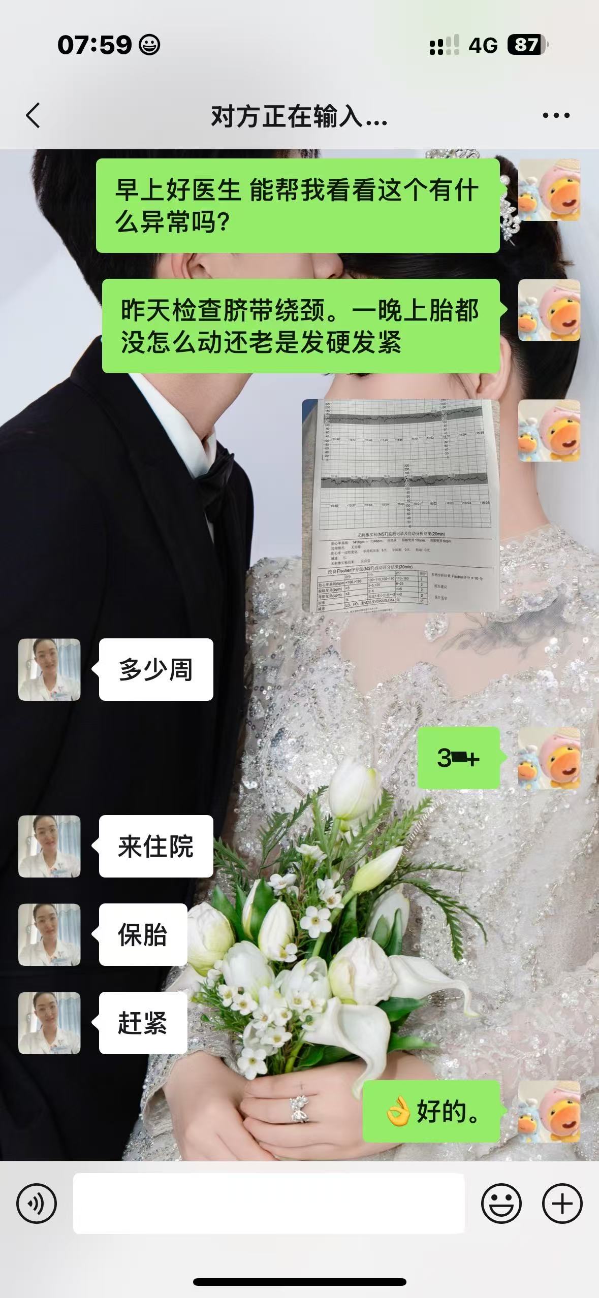 胎监异常图片